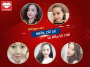 Review nhấn mí, chị em tư vấn: “Cứ mạnh dạn lên, xấu 1 ngày thôi cũng làm ta lỡ nhiều cơ hội thành công”