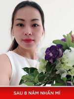 Chiêm Ngưỡng Đôi Mắt Sau 8 Năm Nhấn Mí Của Vũ Thúy