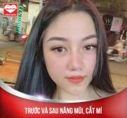  Sau 4 năm thu gọn & tạo môi trái tim: “năm tháng càng dài, hương thơm càng đượm” 