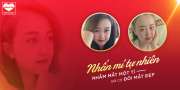  Mai Anh sau 3 tháng nhấn mí: Nhắm mắt một lúc là có mắt đẹp ngay.