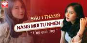  Trúc Anh: Sau 1 tháng nâng mũi ưng ơi là ưng, chị em nhanh đi làm đẹp còn đón Tết
