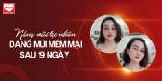  Nâng mũi tự nhiên sau 19 ngày dáng mũi thanh thoát tự nhiên