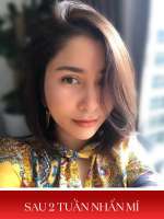 Ơn giời, Phuong Phan sau 3 lần nhấn mí cũng có ngày : “Nhấn mí được 2 tuần chim ưng dã man…”