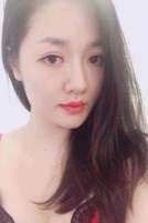 Nàng Phi Yến sau khi nâng mũi được 1 tháng giờ dáng mũi ra sao?