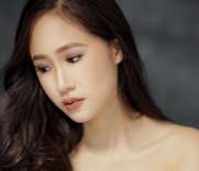  Mắt cũ nhấn mí hỏng be bét bên to bên nhỏ thành 3 mí, Giang phải làm sao…