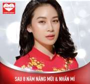 Chi Phí Thực Hiện 1 Ca Nâng Mũi Hết Bao Nhiêu Tiền?