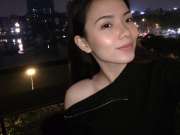 Tâm tư của những cô nàng sau 7 năm nhấn mí hút mỡ nội soi tại Mika Vũ Thái