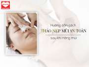 Hướng dẫn cách THÁO NẸP MŨI AN TOÀN sau khi nâng mũi