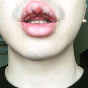  Hành trình làm môi trái tim tự nhiên đẫm nước mắt của chàng trai trẻ