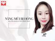 Nâng Mũi Bị Hỏng: Nguyên Nhân Và Cách Khắc Phục