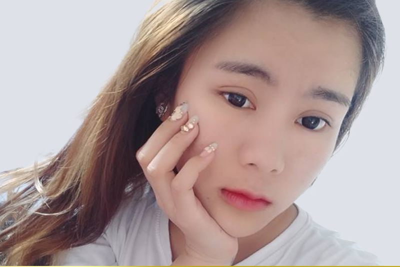 Cắt mí mắt tạo mắt 2 mí tròn đẹp.