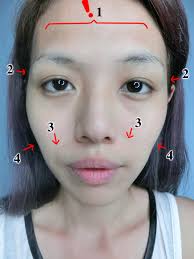 Thái dương hóp khiến gương mặt mất cân đối